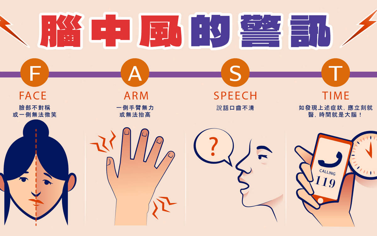 健康專欄-腦中風的前兆與預防方法